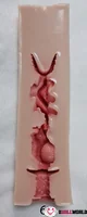#6 (15cm)